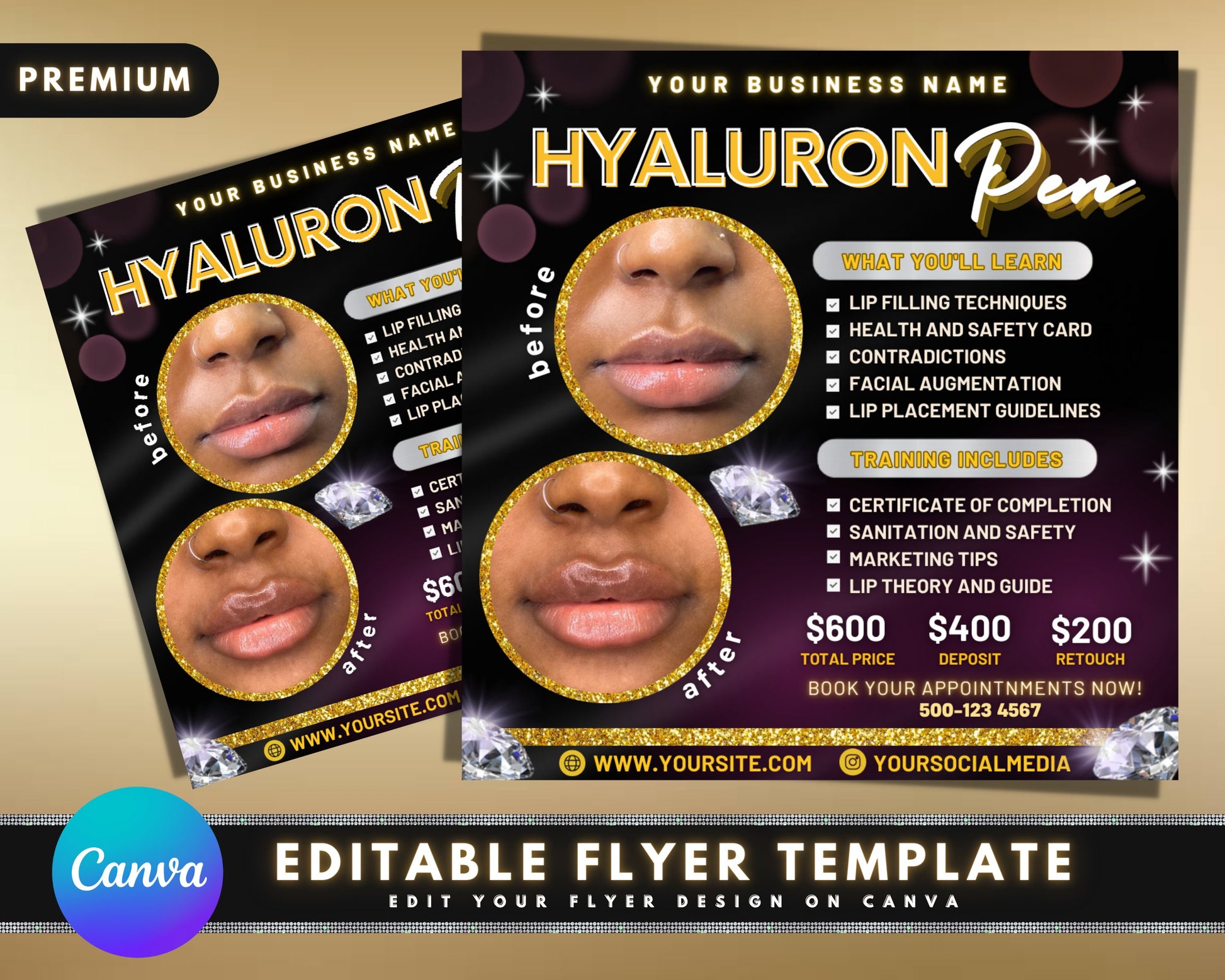 Hyaluron Pen Flyer, DIY Flyer Template Design, Hyaluron Pen Training Flyer, Hyaluron Pen Academy, Premade Lip Filler Course Business Flyer