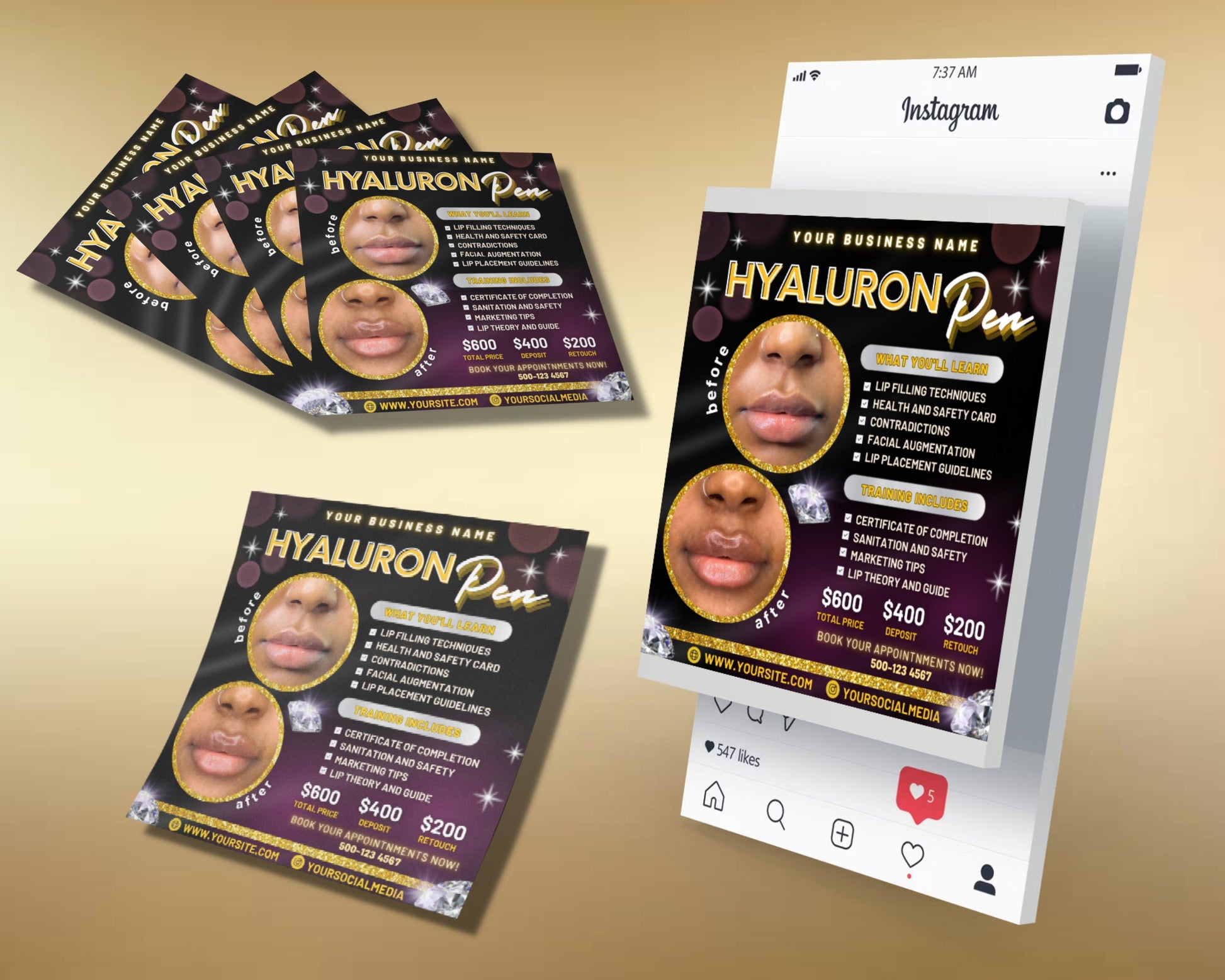 Hyaluron Pen Flyer, DIY Flyer Template Design, Hyaluron Pen Training Flyer, Hyaluron Pen Academy, Premade Lip Filler Course Business Flyer