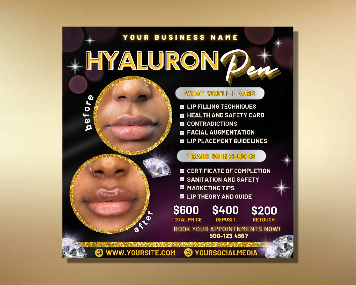 hyaluron pen flyer, diy flyer template design, hyaluron pen training flyer, hyaluron pen academy, premade lip filler course business flyer